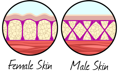 Does Cupping Help with Cellulite? Yes! 3 Ways It Works and How To Do It