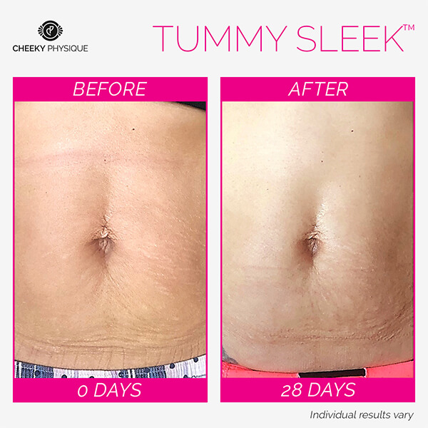 Tummy Sleek before and after results