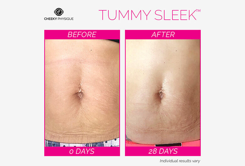 Tummy Sleek Before And After
