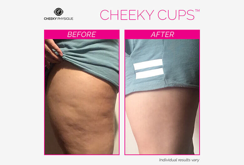Cheeky Cups Before And After