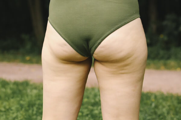 woman's buttocks